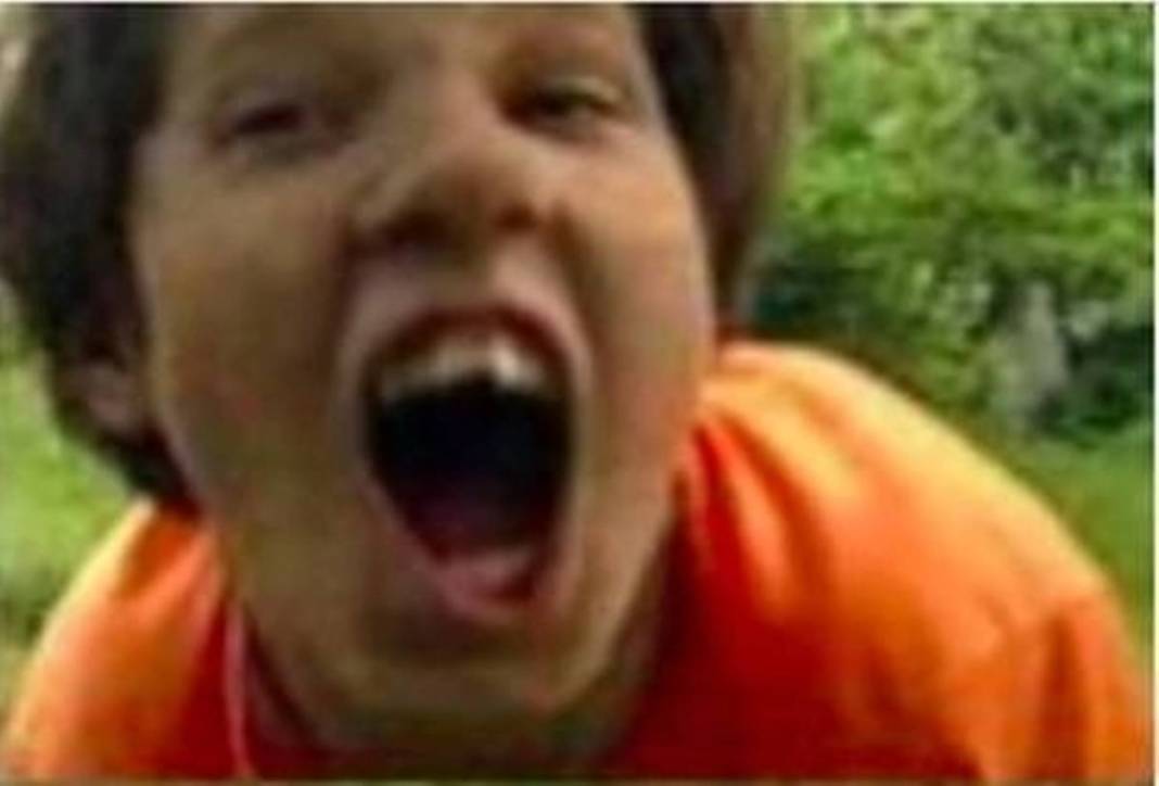 Köpekler tarafından büyütülmüştü, doktorlardan şoke eden rapor! Bir daha asla... 3